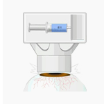 주사기 힘을 이용한 수동 안구 고정방식 이미지 